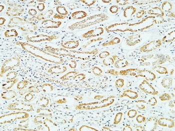 CD83 rabbit pAb Antibody