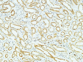 CD83 rabbit pAb Antibody