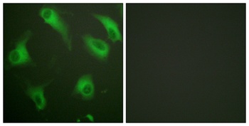 CD88 rabbit pAb Antibody