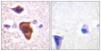 CD88 rabbit pAb Antibody
