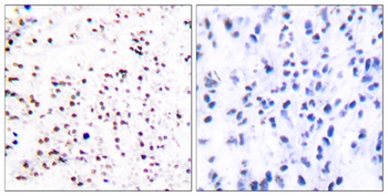 CDC46 rabbit pAb Antibody