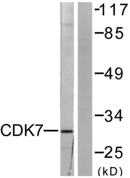Cdk7 rabbit pAb Antibody