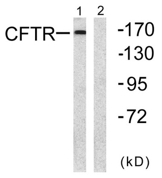 CFTR rabbit pAb Antibody