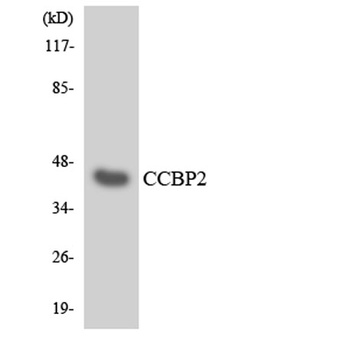 Chemokine Receptor D6 rabbit pAb Antibody