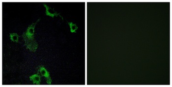 CIDE-B rabbit pAb Antibody