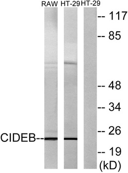 CIDE-B rabbit pAb Antibody