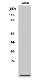 Cks1 rabbit pAb Antibody