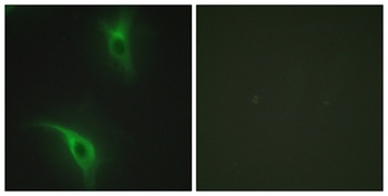 Cks1 rabbit pAb Antibody