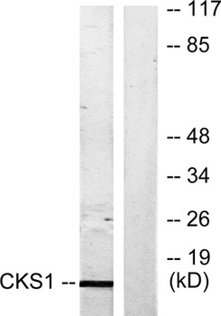 Cks1 rabbit pAb Antibody