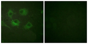 Claudin-3 rabbit pAb Antibody