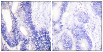 Claudin-3 rabbit pAb Antibody