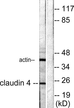 Claudin-4 rabbit pAb Antibody