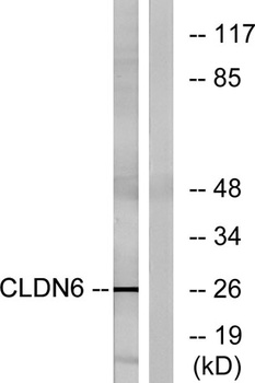Claudin-6 rabbit pAb Antibody