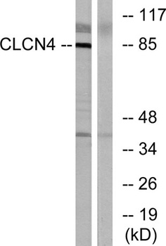 CLC-4 rabbit pAb Antibody