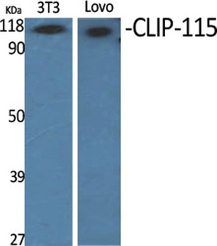 CLIP-115 rabbit pAb Antibody