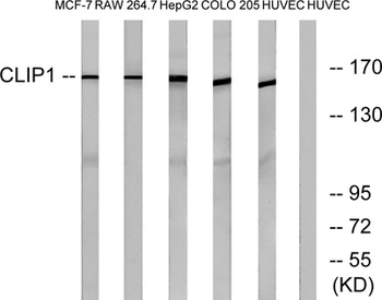CLIP-170 rabbit pAb Antibody