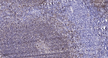 CLIP3 rabbit pAb Antibody