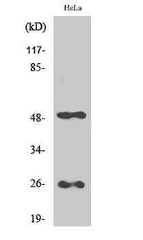Clusterin rabbit pAb Antibody