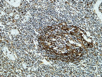 Clusterin rabbit pAb Antibody