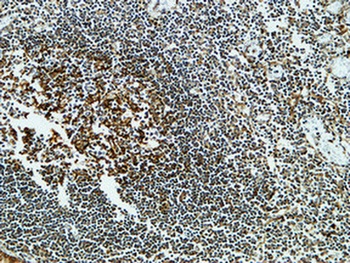 Clusterin rabbit pAb Antibody