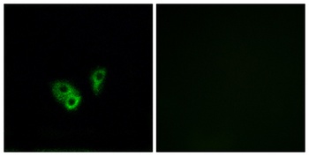 CNG-2 rabbit pAb Antibody