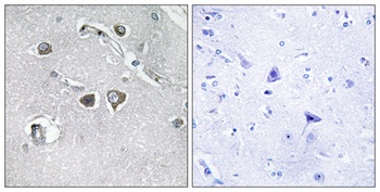 COL11A2 rabbit pAb Antibody