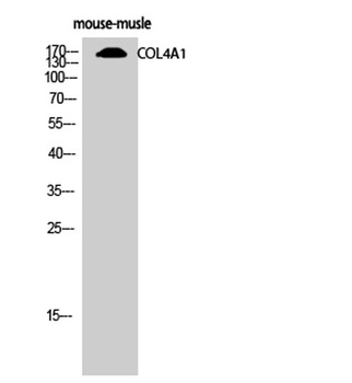 COL4A1 rabbit pAb Antibody