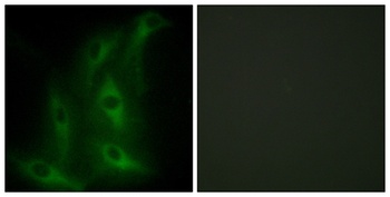 COL4A6 rabbit pAb Antibody