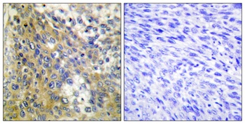 COL4A6 rabbit pAb Antibody