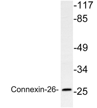 Connexin-26 rabbit pAb Antibody