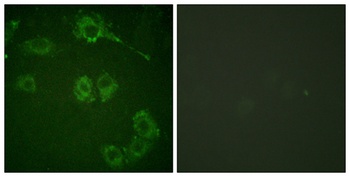 COT rabbit pAb Antibody