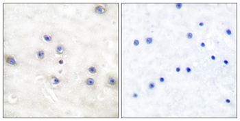 COT rabbit pAb Antibody