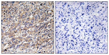 COX17 rabbit pAb Antibody