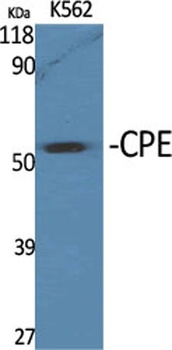 CPE rabbit pAb Antibody