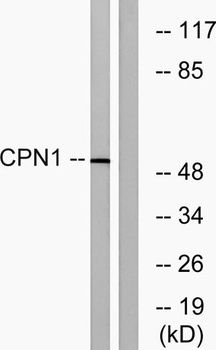 CPN cat rabbit pAb Antibody