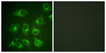 Crk II rabbit pAb Antibody