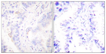 Crk II rabbit pAb Antibody