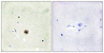 CRP1 rabbit pAb Antibody