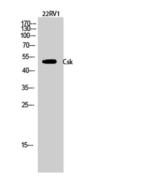 Csk rabbit pAb Antibody