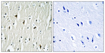 Csk rabbit pAb Antibody