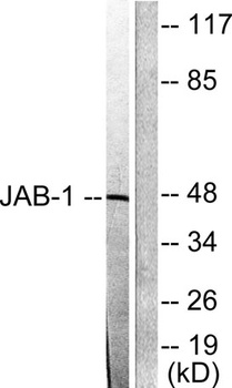 CSN3 rabbit pAb Antibody