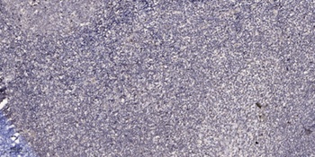 CUG-BP1 rabbit pAb Antibody