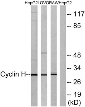 Cyclin H rabbit pAb Antibody