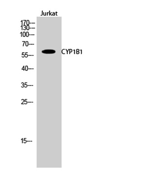 CYP1B1 rabbit pAb Antibody
