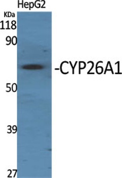 CYP26A1 rabbit pAb Antibody