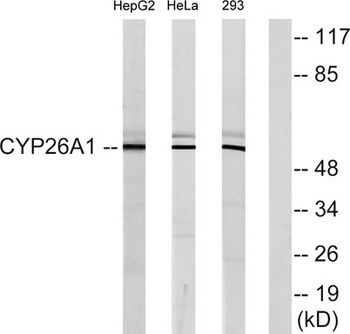 CYP26A1 rabbit pAb Antibody