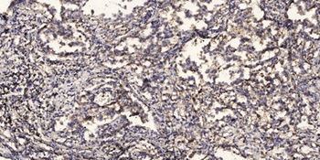 CYP27A1 rabbit pAb Antibody