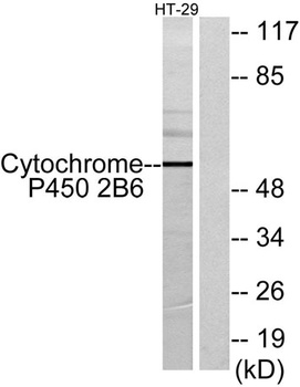 CYP2B6 rabbit pAb Antibody