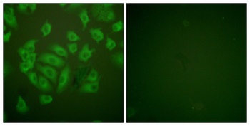 Cystatin A rabbit pAb Antibody