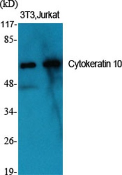 Cytokeratin 10 rabbit pAb Antibody